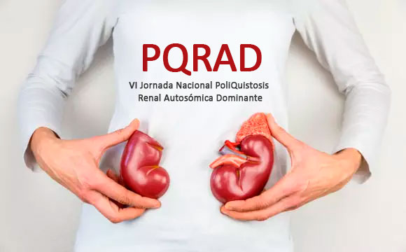 VI Jornada Nacional PoliQuistosis Renal Autosómica Dominante